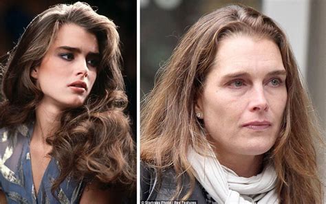 Brooke Shields Brooke Shields Plastic Surgery Before And After The The Best Porn Website