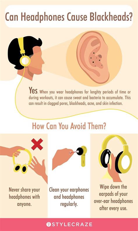 Ways To Get Rid Of Blackheads In The Ears Prevention Tips