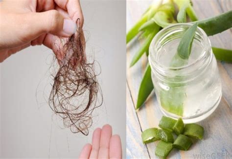 Cómo Hacer Tratamiento Casero Con Aloe Vera Para Detener La Caída Del