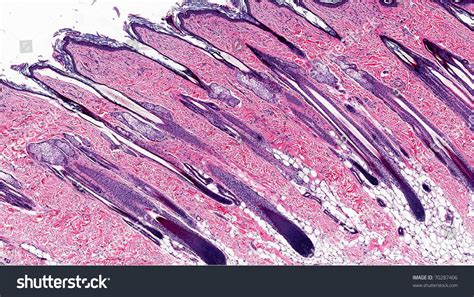 Skin Showing Hair Follicles And Sebaceous Glands Microscopic Anatomy