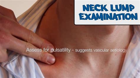Neck Lump Examination Osce Guide New Version Free Medical Neck