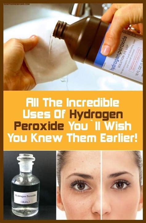 All The Incredible Uses Of Hydrogen Peroxide You`ll Wish You Knew Them