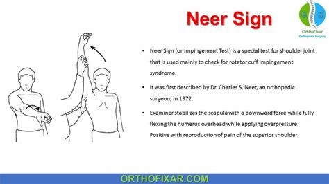 Neer Test Neer Test Or Neer Impingement Test Is A Special Test For