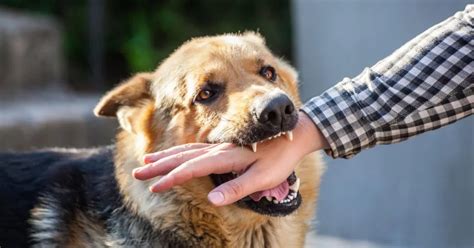 How A Dog Bite Injuries Lawyer Can Support Your Healing Journey From