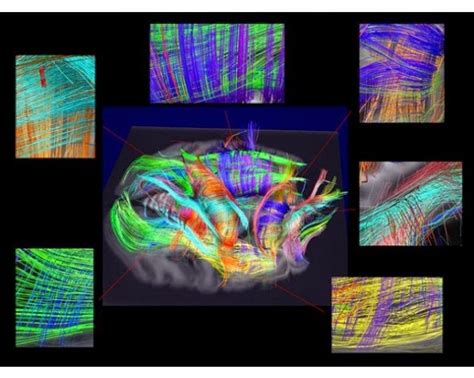 El Cerebro Al Desnudo Las Redes Del Cerebro