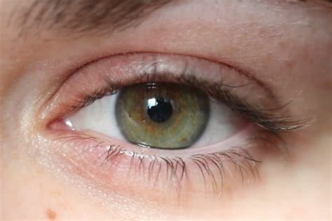 Rarest Eye Color In The World Hot Deals Save 55 Jlcatjgobmx