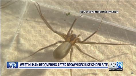 Rising Temps May Mean More Brown Recluse Spiders Youtube