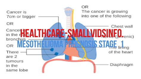 Mesothelioma Prognosis Stage 1 Mesothelioma Disease Progression Youtube