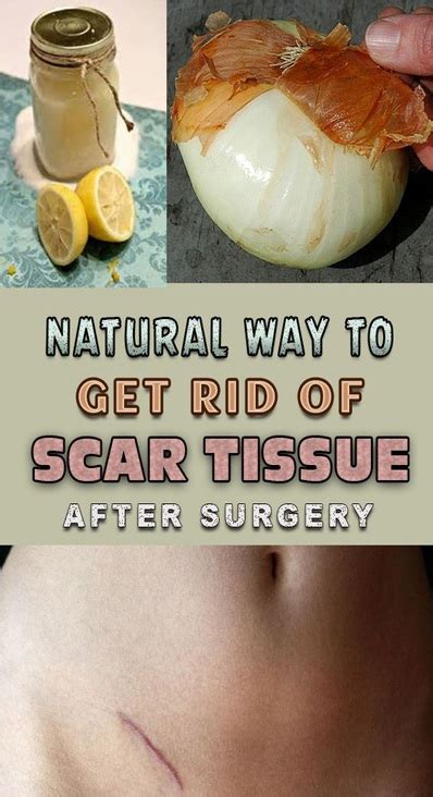 Life At Fit Natural Way To Get Rid Of Scar Tissue After Surgery