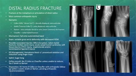 Distal Radius Fracture Distal Radius Fracture Is Fracture Radii