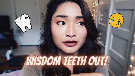 Wisdom Teeth Removal Experience Swelling Face What To Eat Youtube