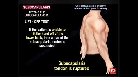 Brachial Plexus Lesions Of The Brachial Plexus Test Your Knowledge