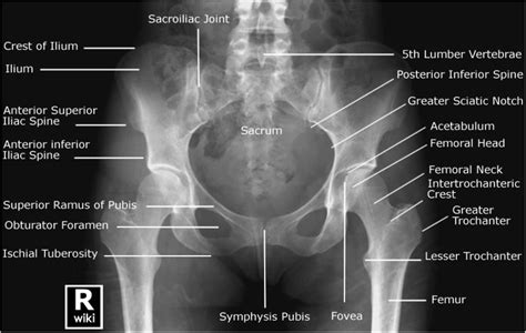 Adult Pelvis Radiographs Trauma Orthobullets