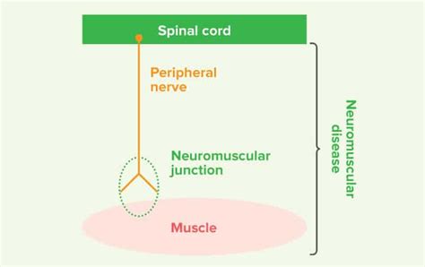 Neuromuscular Disease Ndsr