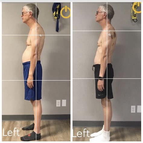 Ryan Reasor Before And After Verticalign Posture Coaching