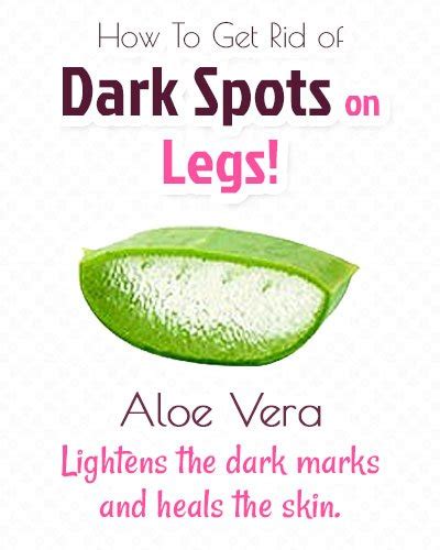 How To Get Rid Of Dark Spots On Legs With Easy Natural Organic Recipes