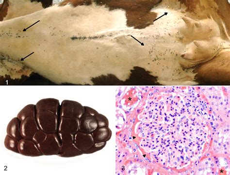 Bovine Babesiosis Diagnosed In Formalin Fixed Paraffin Embedded