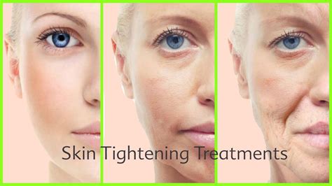 6 Amazing Skin Tightening Treatments You Can Do At Home Youtube