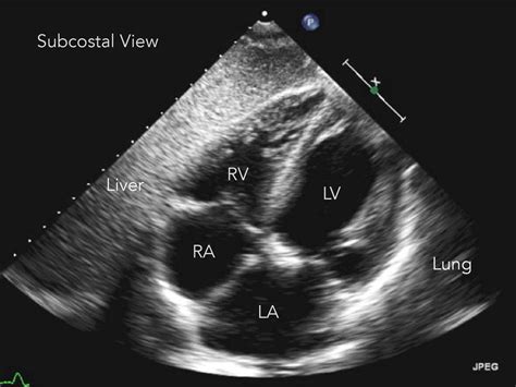 Cardiac — Nuem Blog