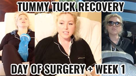 Tummy Tuck Series Episode 2 Day Of Surgery Week 1 Of Recovery