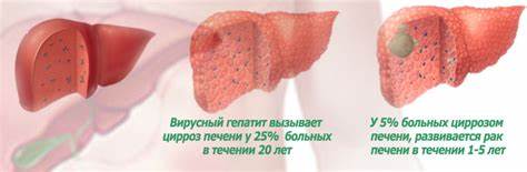 Диета при гепатит в