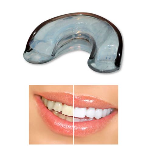 Professional Silicone Tray At Home Teeth Whitening System