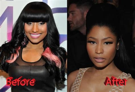 Nicki Before Plastic Surgery Minaj