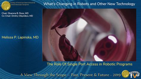 The Role Of Single Port Access In Robotic Programs Youtube