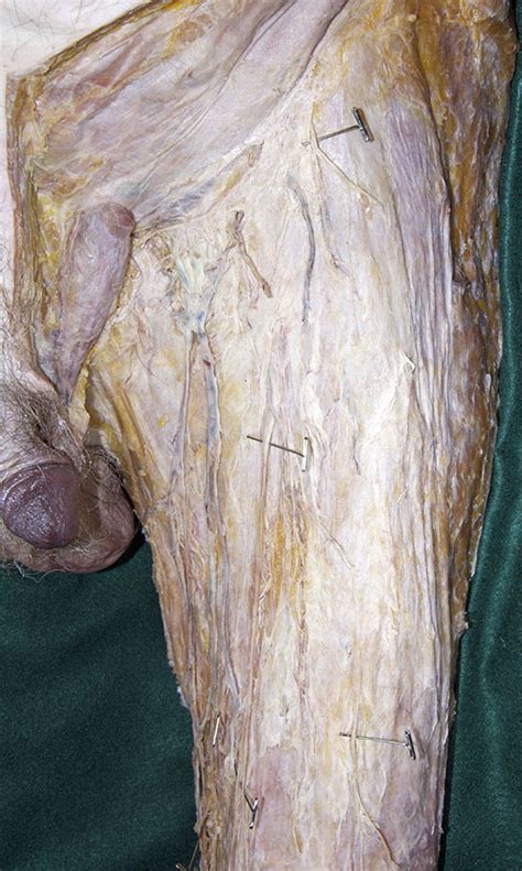 Lower Extremities