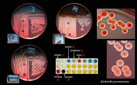 Biochemical Test For Bacterial Identification