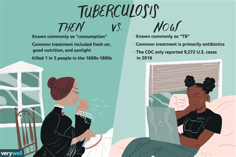 Tuberculosis Tb Overview And More