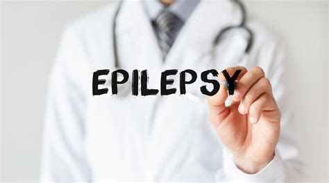 what triggers seizures neurology center for epilepsy and seizures