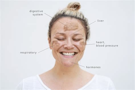 What causes acne can be a tough case to crack, but preventing breakouts just takes a little detective work. Face Mapping: What Your Pimples are Trying to Tell You