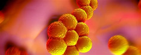 Die abkürzung mrsa steht ursprünglich für „methicillinresistenter staphylococcus aureus und nicht wie fälschlicherweise oft angenommen für „multiresistenter staphylococcus aureus. MRSA: Definition, Symptome, Risikogruppen und Behandlung