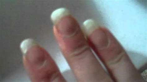 Real Finger Nails Scratching Gonna Cut Them Today Youtube