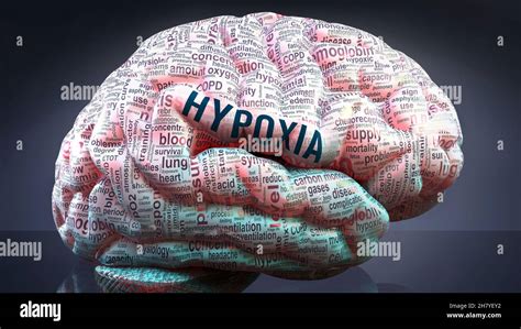 Hipoxia En El Cerebro Humano Fotografías E Imágenes De Alta Resolución