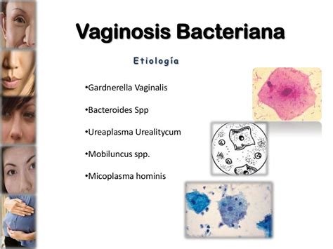 Vaginosis Bacteriana Sexualidad