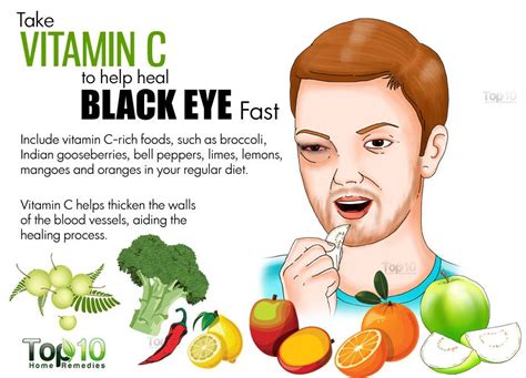 How To Get Rid Of A Black Eye Fast Top 10 Home Remedies