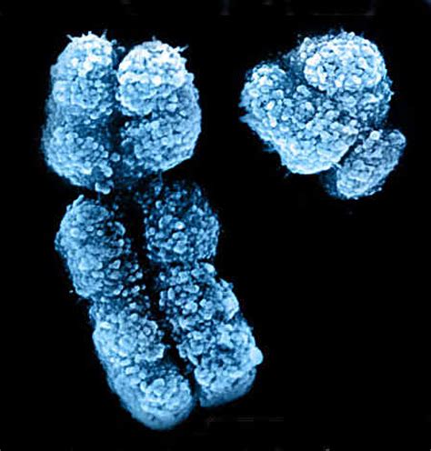 This is because males have xy chromosomes and females have xx. X chromosome | UCL Me & My Genes