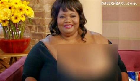 Meet Annie Hawkins Turner Woman With The Largest Boobs In The World