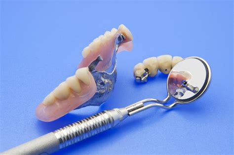 Prótesis De última Generación Clinica Dental Doctora Ayet Tu
