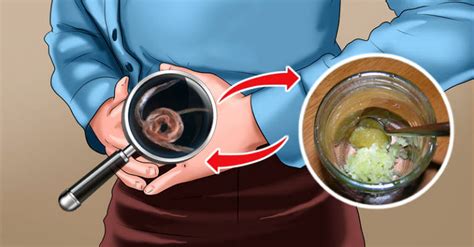 Get Rid Of Parasites Fast With Only 1 Natural Ingredient