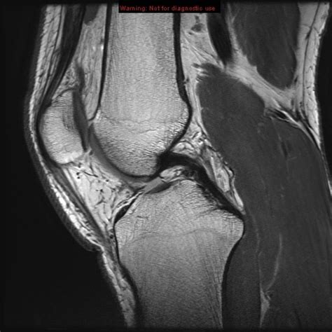 Knee mri is one of the more frequent examinations faced in daily radiological practice. Knee Muscle Anatomy Mri / Mri Knee Joint Anatomy - Find out more about the benefits of cbd via ...