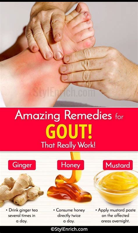Home Remedies For Gout Home Remedies For Gout Natural Cure For