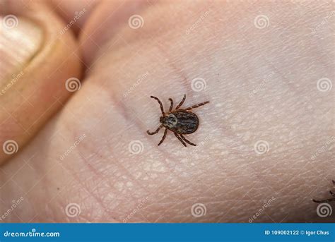 A Dangerous Tick On Human Skin Royalty Free Stock Photography