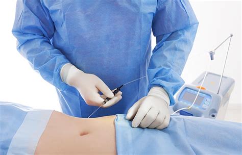 In the united states, liposuction is the most common cosmetic surgery. Laser Liposuction - Laser Fat Removal To Blast Fat