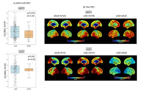 Fdg Pet Features Of Lewy Body Dementia Among Patients With Amnestic