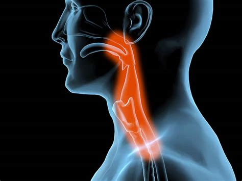 Neck And Throat Cancer Pdx Ent