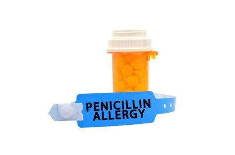 Un Diagnosing Penicillin Allergy Allergy And Immunology Located In