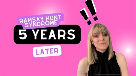 Ramsay Hunt Syndrome 5 Years Later Youtube